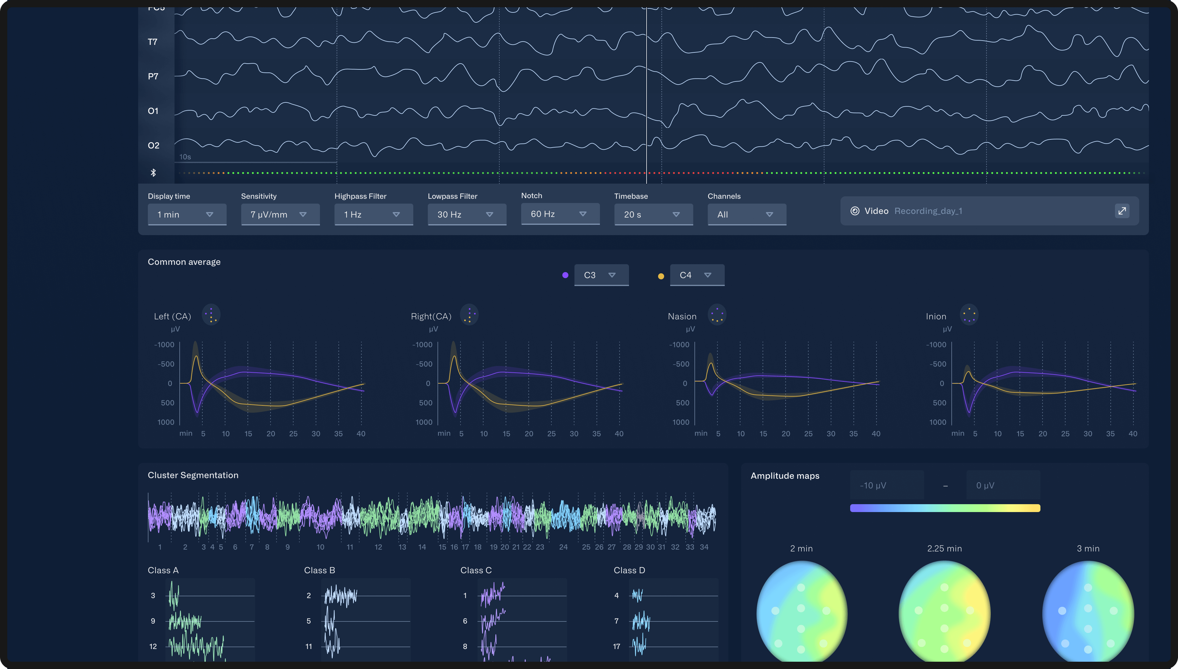 The image shows a mockup of a screen, displaying different colorful data visualizations. At the top, there are EEG waveforms, followed by other visualizations such as line graphs and heat maps.